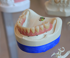 Dental Fillings Norwalk CT